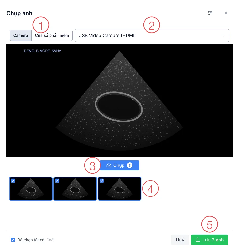 Ô Chụp ảnh với camera, 5 vị trí được đánh số