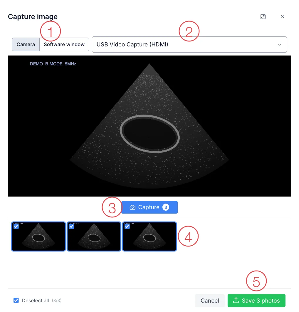 The Capture image window with a camera, five positions numbered